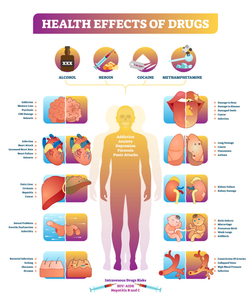 cocaine-psychosis-rehab-guide