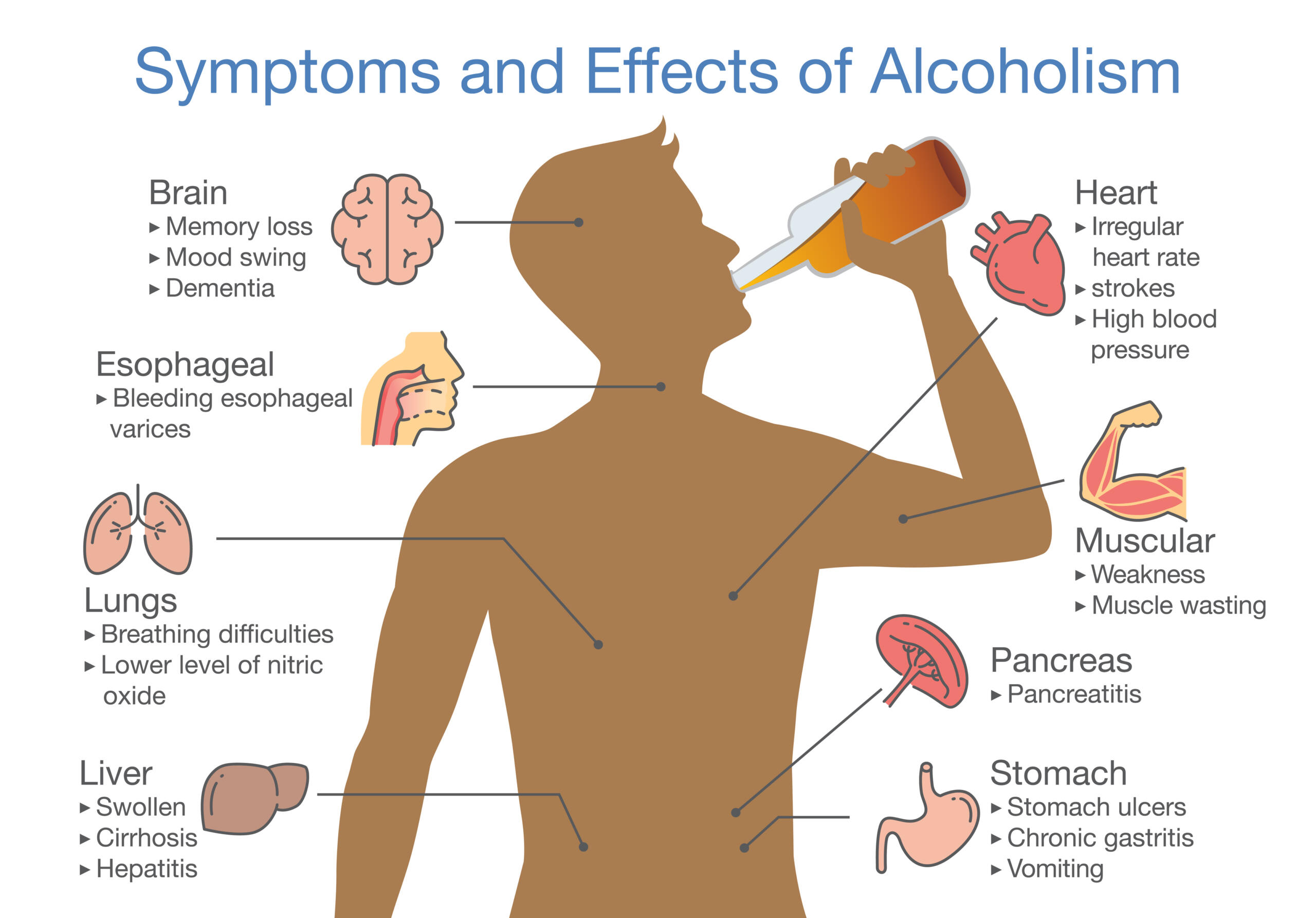Alcoholism: Effects on the Body and Health Risks Image showing symptoms and health effects of alcoholism on the body
